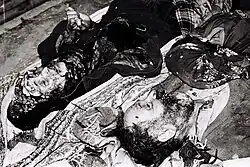 Vítimas civis azeris do Massacre de Khojaly.