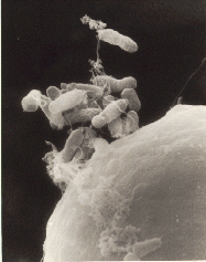 Agrobacterium tumefaciens da ordem Rhizobiales