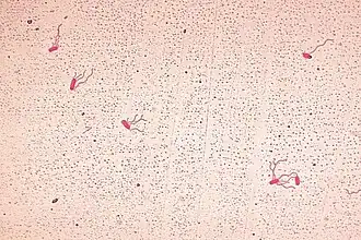 Alcaligenes xylosoxidans