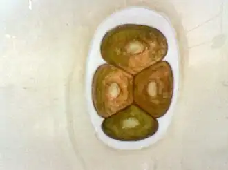 Ovo de Ancylostoma duodenale