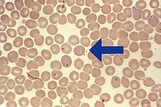 Babesia sp. infectando hemácias.