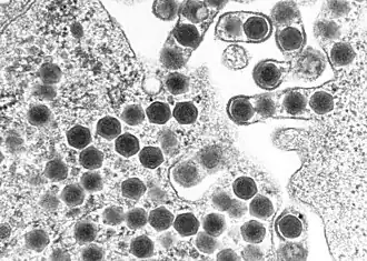 Eletromicrografia de um corpo de inclusão de um nucleopolyhedrovirus.