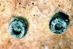 Espécimen de Conotrema urceolatum em herbário (ampliação 40X )