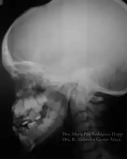 Falta de desenvolvimento do nível médio e inferior.