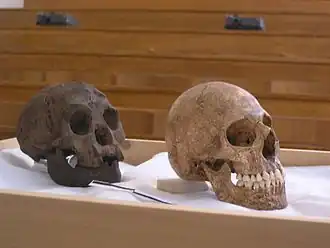 Comparação entre o crânio LB1 (à esquerda) e crânio de humano moderno com microcefalia.