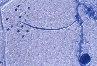 Hifa de Hyaloperonospora parasitica crescendo no interior da folha de Arabidopsis thaliana, vista ao microscópio.