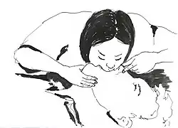 Respiração "boca-a-boca" (2 para cada 30 compressões)