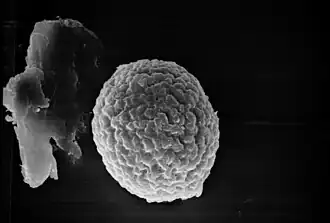 Esporo de Tilletia indica