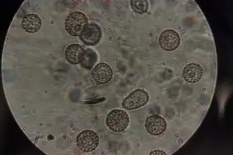 Microbotryum saponariae, um Microbotryomycetes