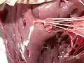 Músculos papilares e chordae tendinae