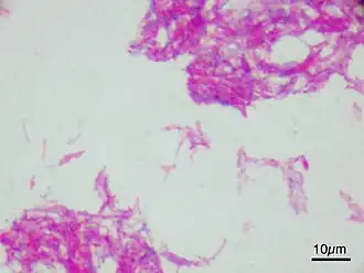 Mycobacterium bovis.