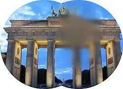 Escotoma negativo, perda da percepção de estruturas locais