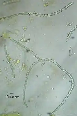 Microfotografia de N. azollae