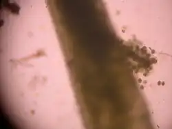 Nothoceros vincentianus de uma floresta tropical do sul do Brasil (esporos retirados do esporófito).