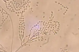 Fiálides divergentes, e longas cadeias enredadas de conídios elípticos com origem em estruturas frutíferas mais complexas de Paecilomyces lilacinus; ampliação 460X.