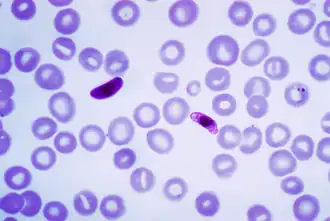 Plasmodium falciparum no sangue
