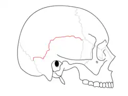Sutura escamosa separa osso parietal e o escamoso do osso temporal.