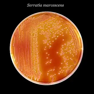 Serratia marcescens