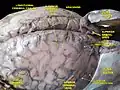 Meninges e veias cerebrais superficiais. Dissecação profunda. Vista Superior.