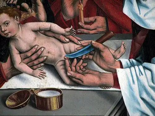 Circuncisão de Jesus. Detalhe do "Altar dos Doze Apóstolos" de Friedrich Herlin (1466).