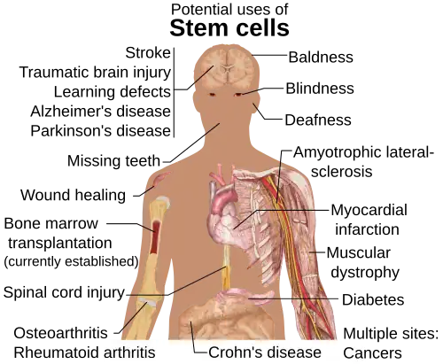 Áreas do corpo humano onde a aplicação da terapia com células-tronco[7] é promissora.