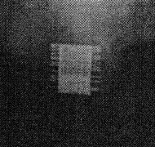 Uma radiografia x de um ZSI 375. O aparelho se encontra ativado - a mola é descomprimida no topo do cilindro. O paciente está continente.