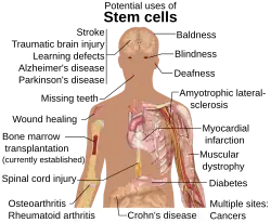 Áreas do corpo humano onde a aplicação da terapia com células-tronco[5] é promissora.