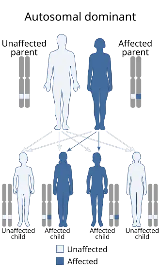A diagram of the autosomal dominant inheritance pattern, showing how a gene can be passed from an affected parent to an affected child.