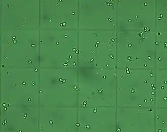 Brettanomyces bruxellensis