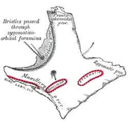 Osso zigomático esquerdo. Superfície de Malar.