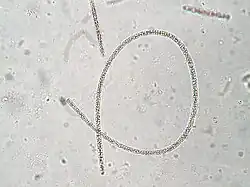 Planktothrix rubescens, uma espécie de Oscillatoriales.