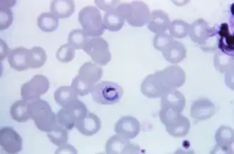 Trofozoíto de Plasmodium ovale