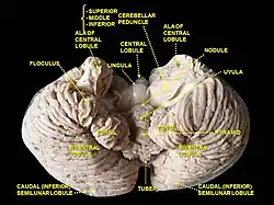 Cerebelo. Superfície inferior.