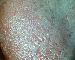 Língua humana e papilas gustativas