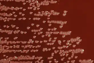 Colónias de Yersinia enterocolitica numa placa de ágar sangue.