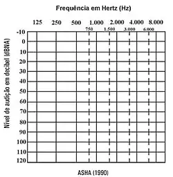 Gráfico representando as frequências de 250Hz à 8kHz.
