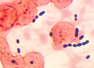 Pneumonia causada por Enterococcus sp.