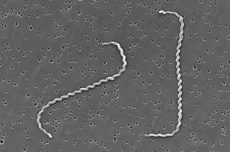 Scanning electron micrograph of Leptospira interrogans.
