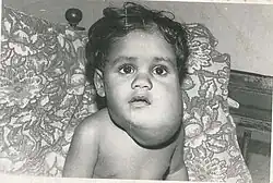 O mesmo paciente após a primeira cirurgia.