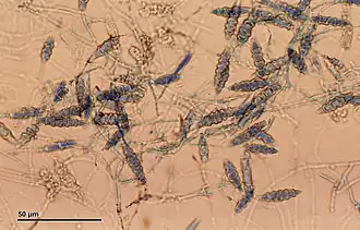 Microsporum gypseum e a presença de macroconídios fusiformes.