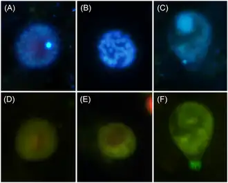 Parvilucifera. (A–C) Esporângios com núcleos corados com DAPI. (D–F) Esporângios com autofluorescência verde sob excitação com luz azul.