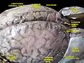 Meninges e veias cerebrais superficiais. Dissecação profunda. Vista Superior.