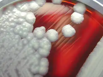 Colônias de B. cereus em placa de ágar com sangue de carneiro.