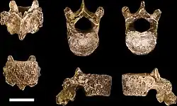 Vistas de uma 10ª vértebra torácica