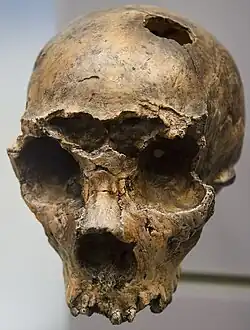 Um crânio sem dentes, com um grande corte entre os olhos e um buraco bem definido na caixa craniana esquerda