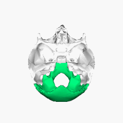 Superfície interna sem o frontal e o parietal.