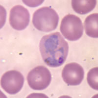 Plasmodium vivax
