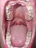 Interior bucal humano