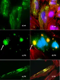 Microscopia de fluorescência de expressão de DNA no Human Wild-Type and P239S Mutant Palladin.