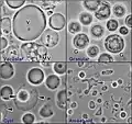 Blastocystis hominis (Blastocystea)